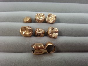 金歯.買取,沖縄,那覇