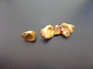 川越市で金歯のお買取は大吉川越店にお任せください。