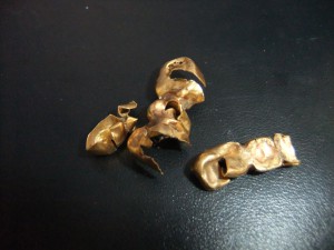 金 金歯