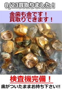 株価も金プラも下落中だけど、金歯は高価買取の大吉西院店