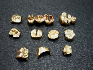 池田市のお客様から金歯を買取致しました。大吉池田店です。