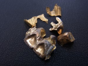 板橋区ときわ台のお客様より金歯お買取りです。地域No.1高価買取宣言中の大吉東武練馬店です!