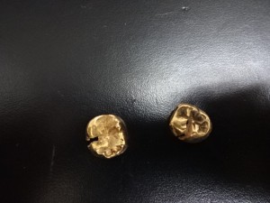 大吉 調布店で買取した金歯