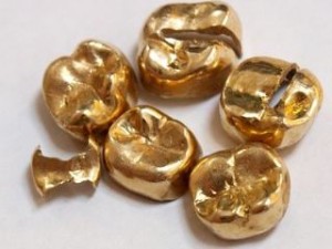 金歯の買取ならぜひ大吉サンシパーク桑名店に来てください。