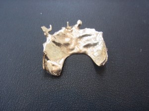 板橋区のお客様より金歯をお買取しました。地域No.1高価買取宣言中の大吉東武練馬店です!