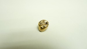 久留米市で金歯の高価買取は買取専門店 大吉です!!