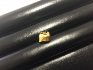 札幌で金歯を売るなら大吉円山公園店にお任せください