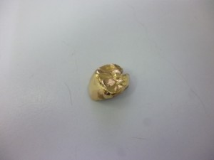 金歯　買取　新丸子