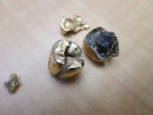 金歯お買取致しましたー!大吉津田沼店です!