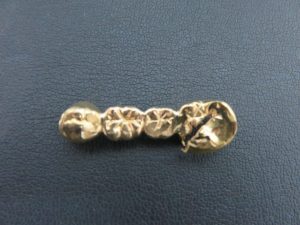 金歯の買取は、池田市の大吉池田店へ