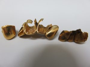 金歯買取りました！金なら大吉グラード伊集院店！