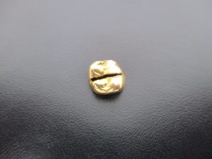 金歯も高額査定実施中!藤沢市で地域No.1高価買取宣言中!大吉藤沢店です。