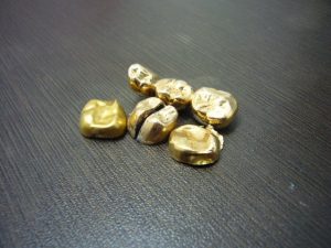 金歯を都筑区にお住まいのお客様からお売りいただきました。|大吉センター北店