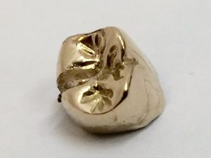 金歯、買取、あすみが丘