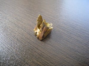 都筑区にお住まいのお客様から金歯を買取りしています。|大吉センター北店