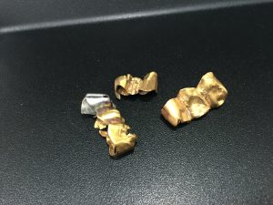 金歯のお買取りもお任せください!買取専門店大吉イオンタウン仙台泉大沢店です!