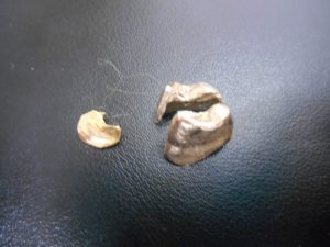 遺品整理の金歯を買取専門店 大吉 JR八尾店で買取りました。