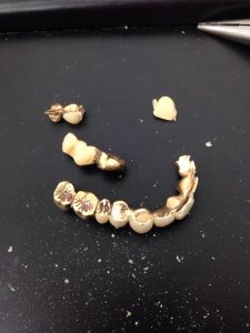 金歯もお買取り出来るんです!!大吉アクロスプラザ札幌南店☆