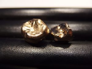 横浜市中区で金歯の買取なら買取専門店 大吉 カトレヤプラザ伊勢佐木店。