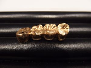 横浜市中区で金歯の買取なら買取専門店 大吉 カトレヤプラザ伊勢佐木店。