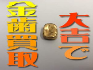 長岡天神大吉で金歯買取
