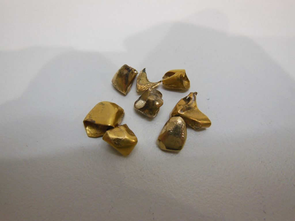 豊田市の金歯買取は、大吉豊田店ににお任せください★