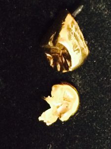 金歯買取りました！大吉小倉店です（北九州）