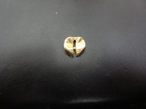 金歯を買取専門店　大吉　JR八尾店で買取しました。