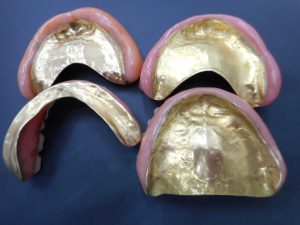 歯科板金 金歯をお買取り！大吉ゆめタウン八代店