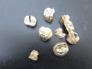金歯をお買取りさせて頂きました。