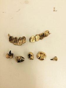 金歯の換金ができる大吉川越店です