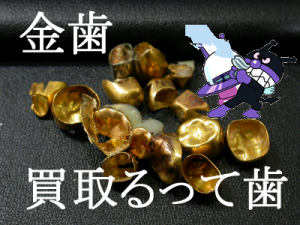 買取 長岡天神 金歯