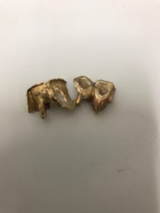 東灘 金歯 買取 甲南山手