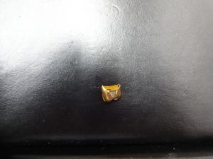 金歯? 金歯もお買取する買取専門店 大吉 JR八尾店です。