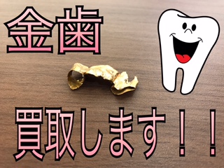 京都北区で金歯を売るなら買取専門店イズミヤ白梅町店にお任せください(^_-)-☆