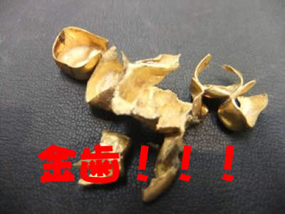 金歯お買取りしました!!京都市北区の大吉イズミヤ白梅町店