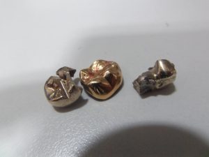 金歯,買取,海老名,座間,綾瀬,相模原