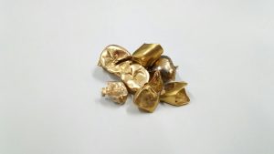 センター北,センター南,金歯,買取