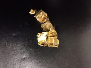 センター北,センター南,金歯,買取したい