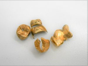 金歯の買取なら、「大吉」久米川店へ！！