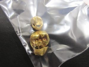 富士で金歯の高価買取は大吉アピタ富士吉原店です。