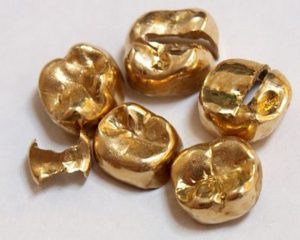 金歯507799c348a3d1e2c1a1d77ff24241d-640x512