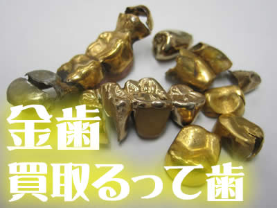 買取 金歯 京都
