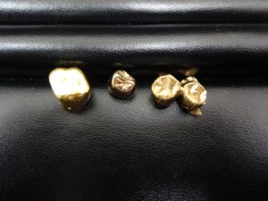 ビックリ価格!買取専門店 大吉 JR八尾店に金歯をお売り下さい。