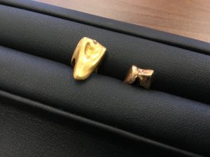 保管していた金歯を売るなら今!大吉ピアシティ荒川本郷店まで