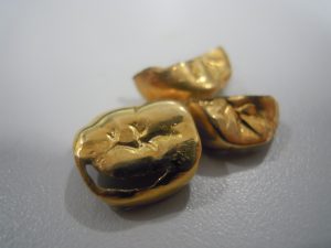 金歯買取大吉大船店