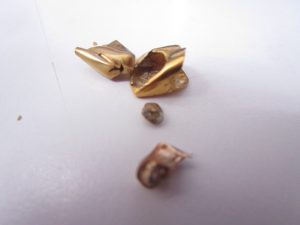 金歯 買取 新丸子