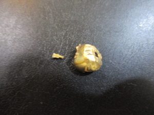 大吉 武蔵小金井店 金歯の画像です。