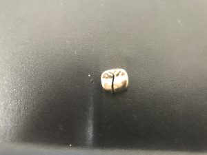 芦屋 金歯 買取 甲南山手