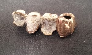 金歯　買取り　厚木